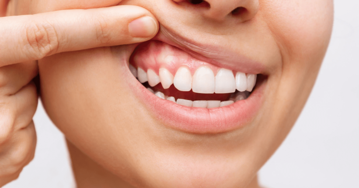 Periodoncia a Vilanova i la Geltrú