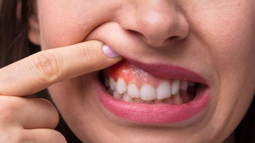Odontologia De Conservació A Vilanova