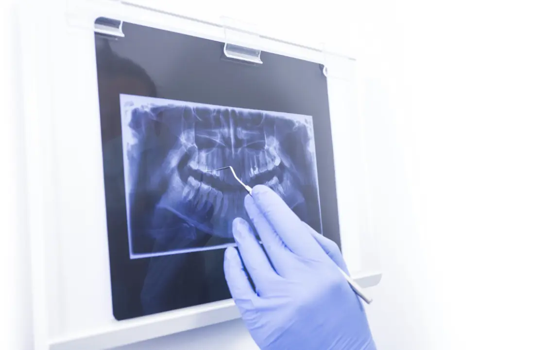 Empast dental