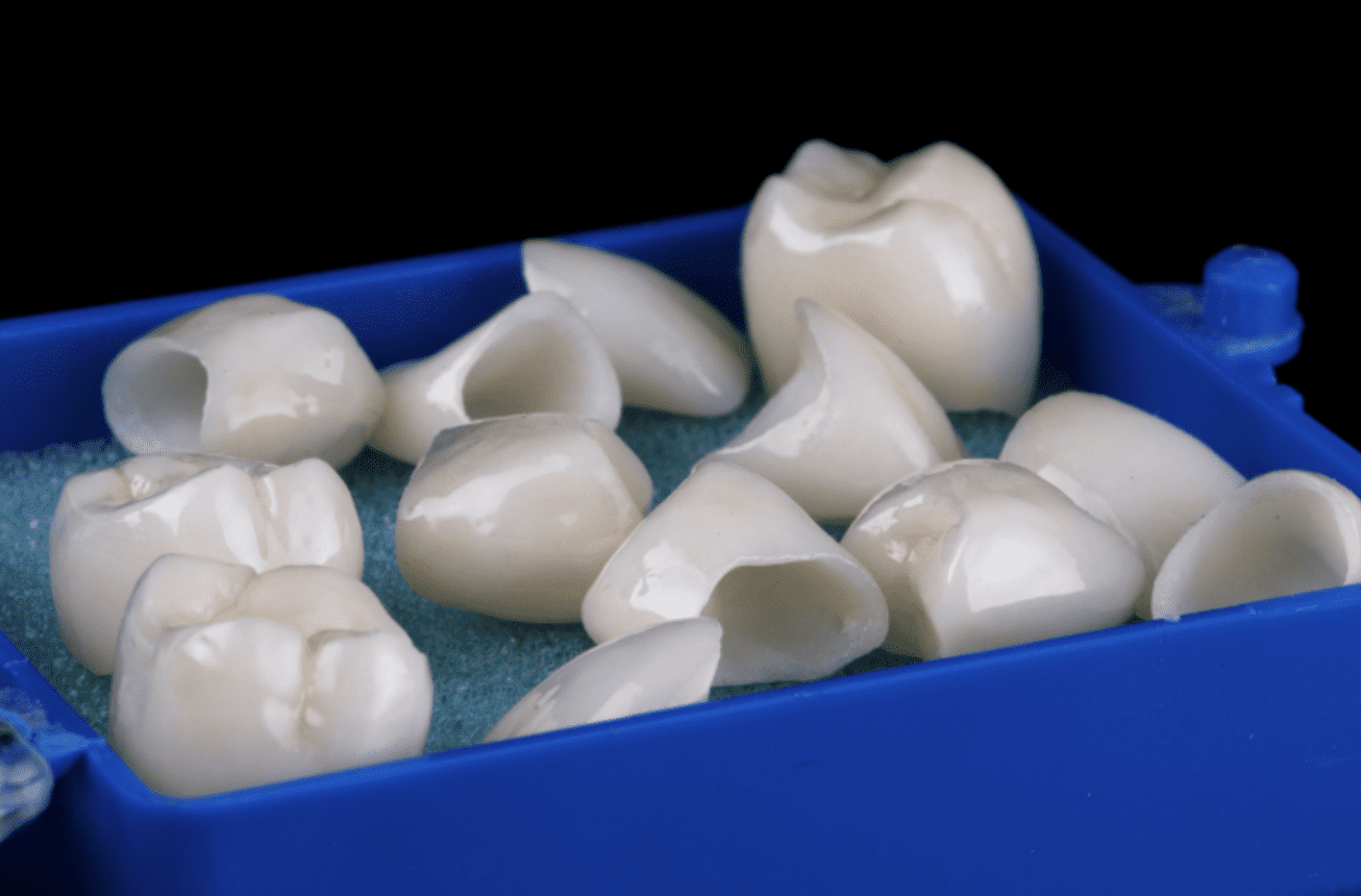 Corona o un Implant Dental