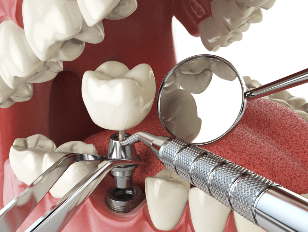 Dentistes Vilanova I La Geltru