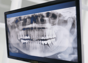 Odontologia Preventiva