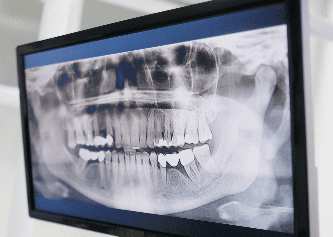 odontologia Preventiva
