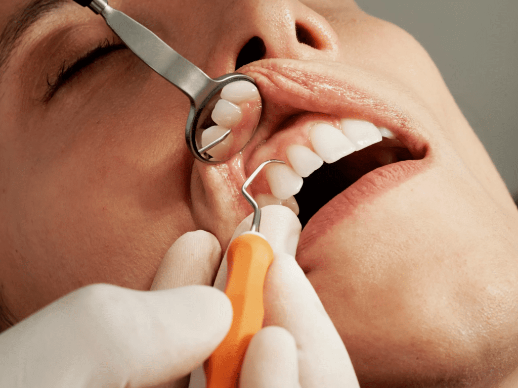 Dental cleaning