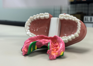Blog - Consells De Salut Bucodental Implants Dentals A Vilanova