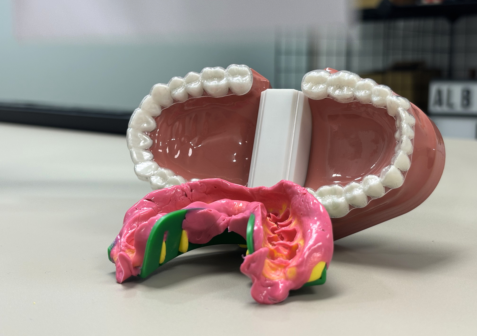Implants dentals a Vilanova